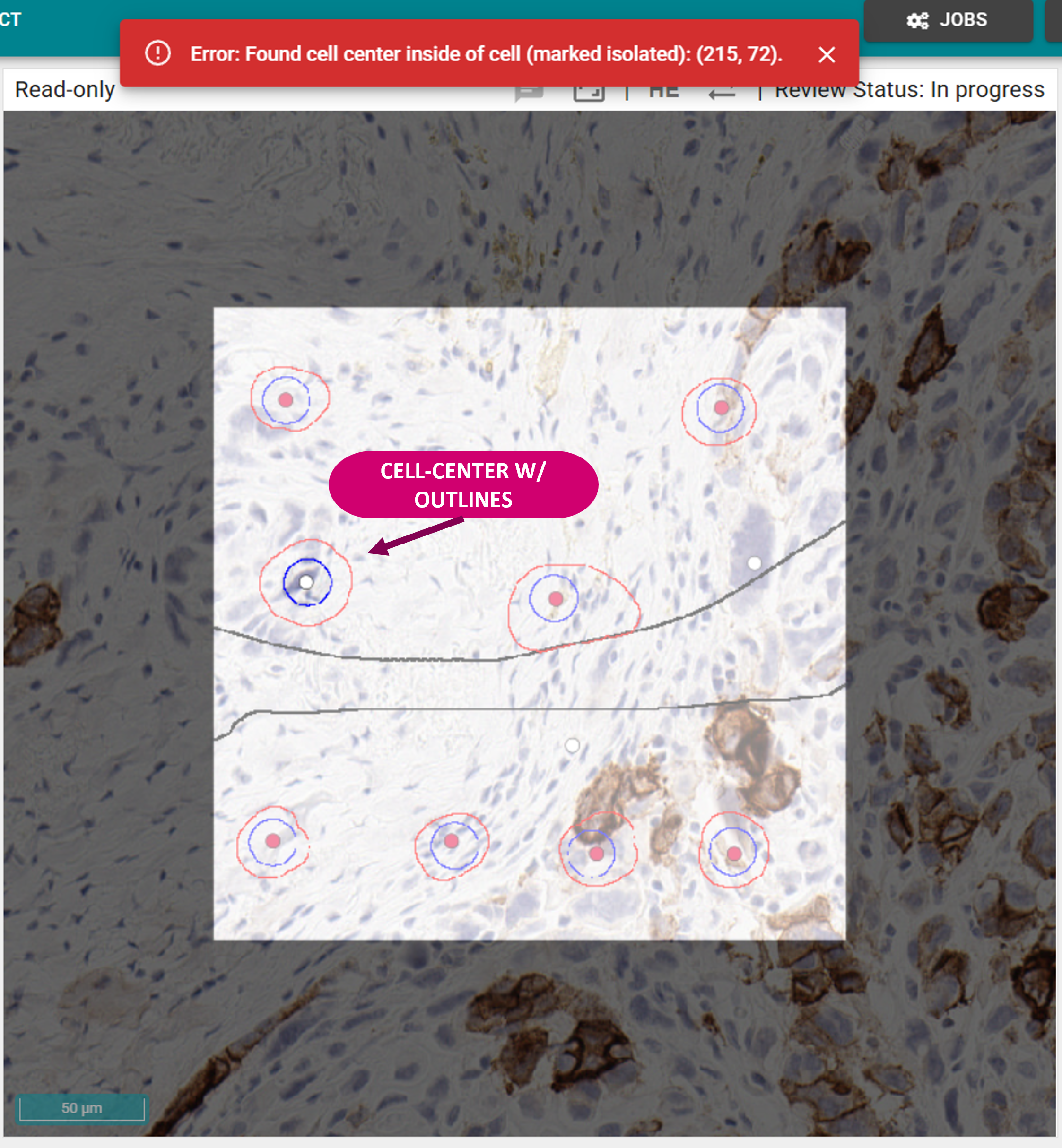 Annotate SSTC Cell Center With Outline in Test Set Workflow