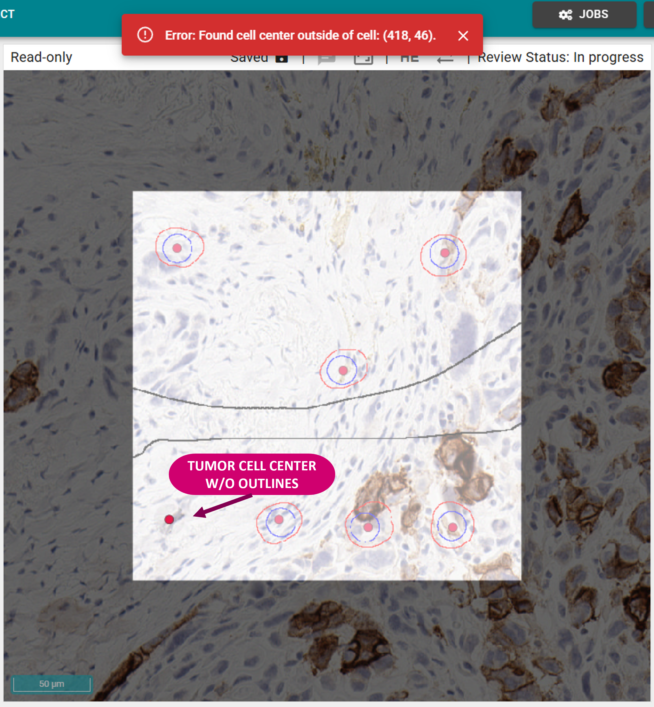 Annotate SSTC Tumor Cell Without Outline in Test Set Workflow