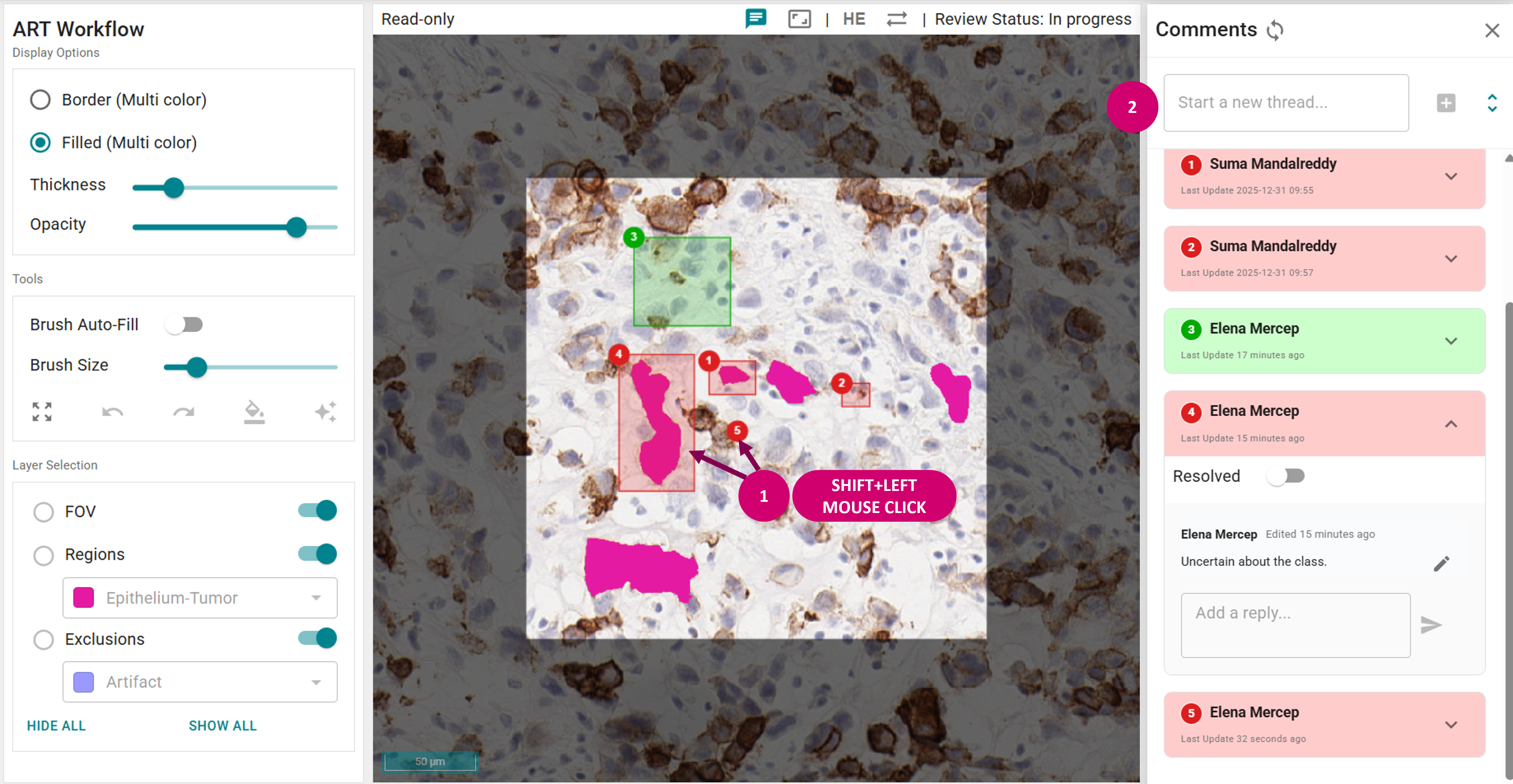 Add spatial RACTcomments